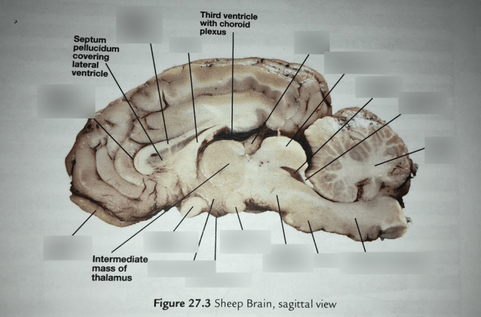 Sagittal view of sheep brain