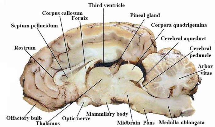 Sagittal view of sheep brain