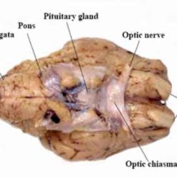 Sagittal view of sheep brain