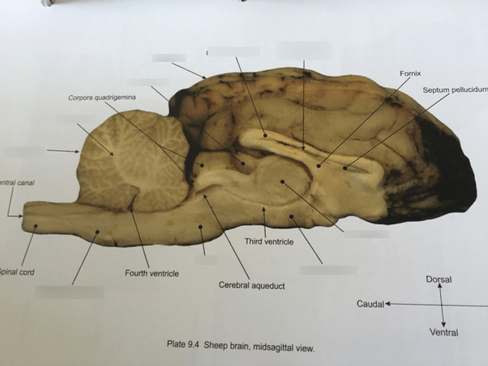 Brain sheep sagittal lateral section ventricle anatomy