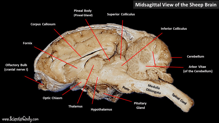 Sagittal view of sheep brain